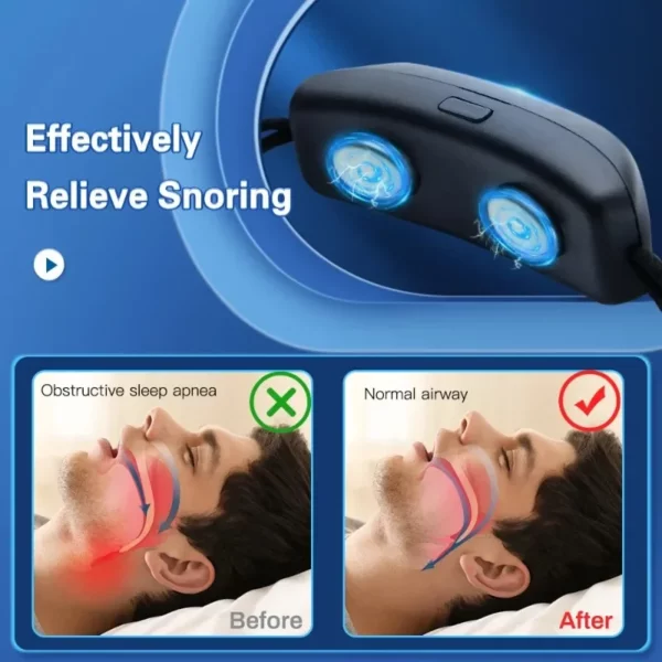 Sb6e5eb06dc92454bb7e902f266401c10a.webp Smart Anti Snoring EMS Sleep Device
